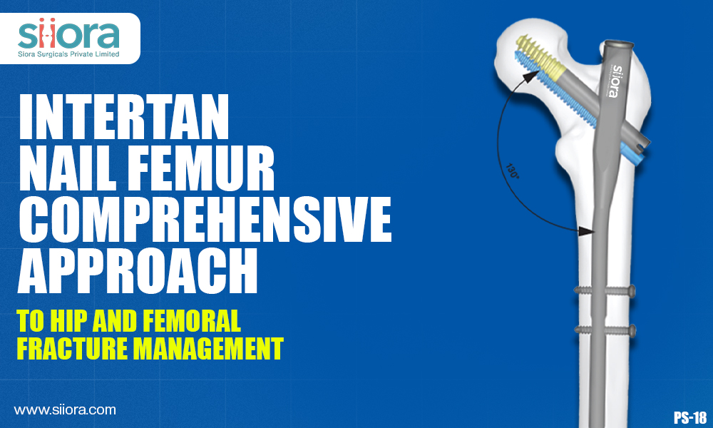 Intertan Nail Femur: Comprehensive Approach to Hip and Femoral Fracture&nbsp;Management