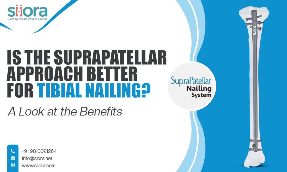 Is the Suprapatellar Approach Better for Tibial Nailing? A Look at the&nbsp;Benefits