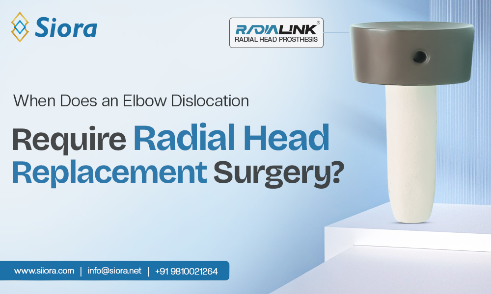 When Does an Elbow Dislocation Require Radial Head Replacement&nbsp;Surgery?